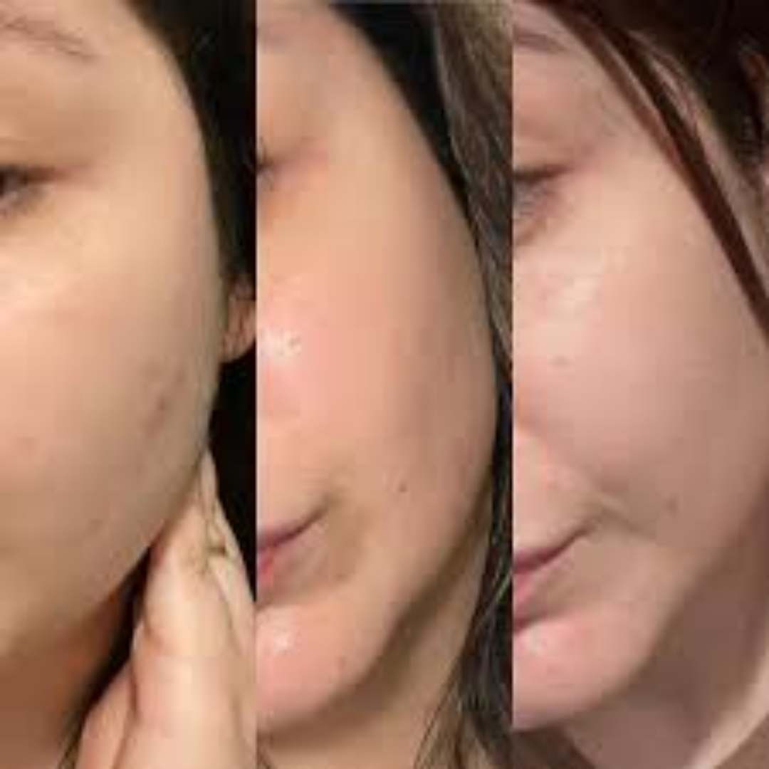 Serum De ADN Salmon MEDICUBE 🌷🐟