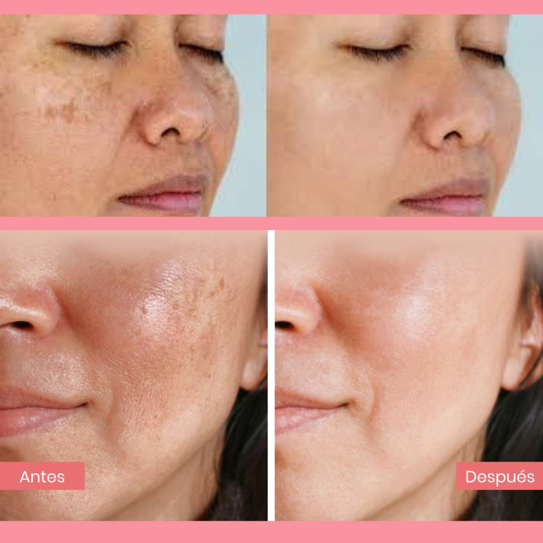 Serum De ADN Salmon MEDICUBE 🌷🐟