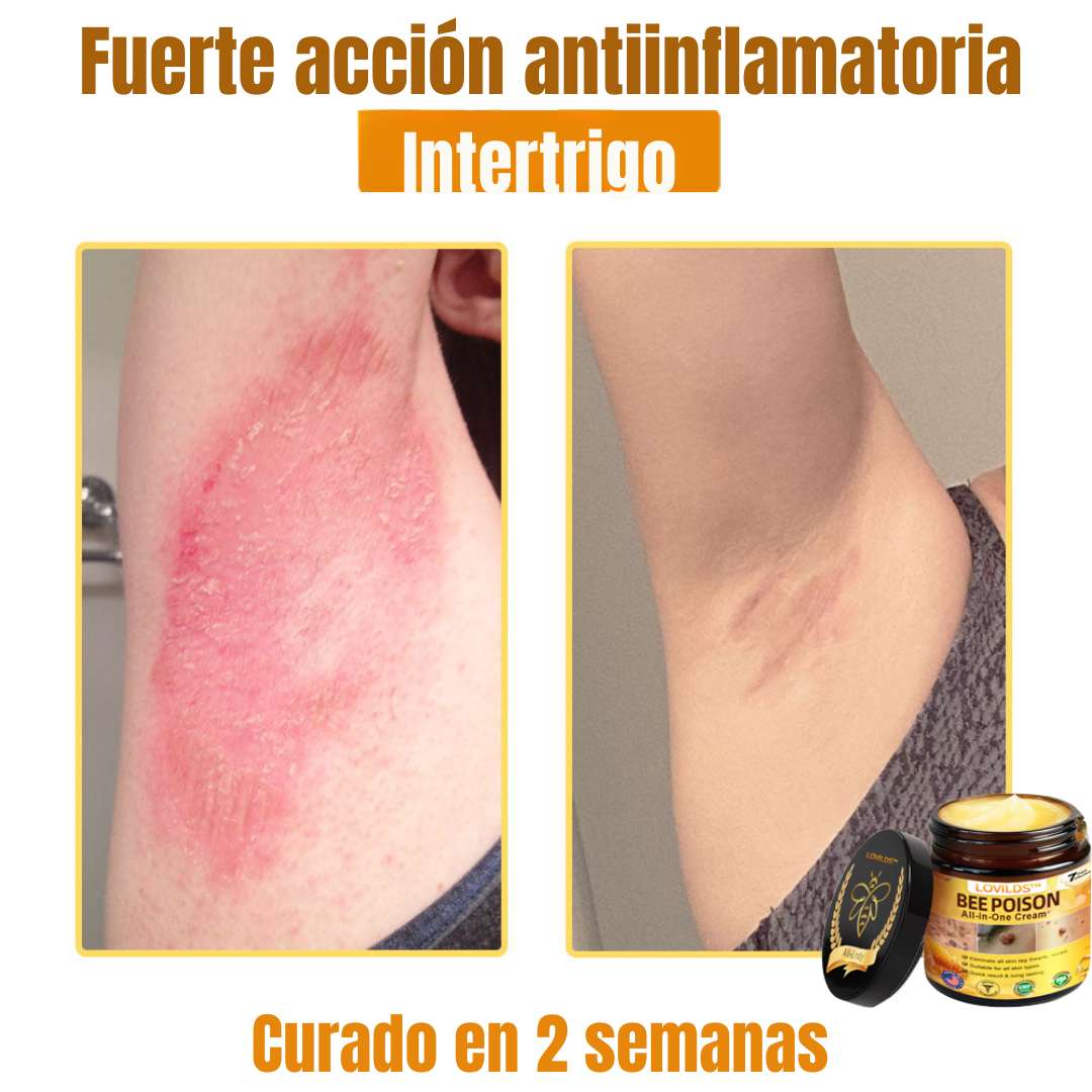 LOVILDS™ Bee Poison Cream  – Potencia natural para tu piel 🌿