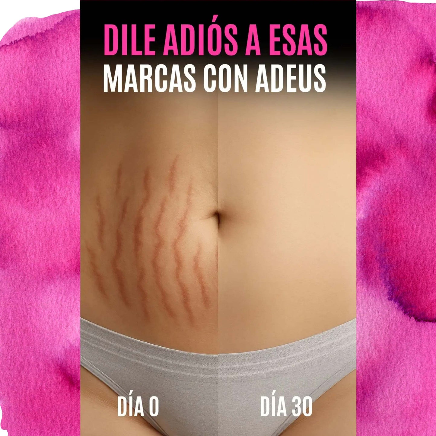 Adeus Crema™– Piel firme, suave y sin celulitis , Estrias ✨🌺