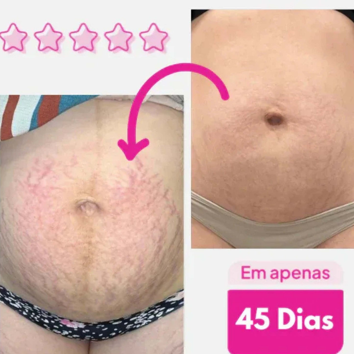 Adeus Crema™– Piel firme, suave y sin celulitis , Estrias ✨🌺