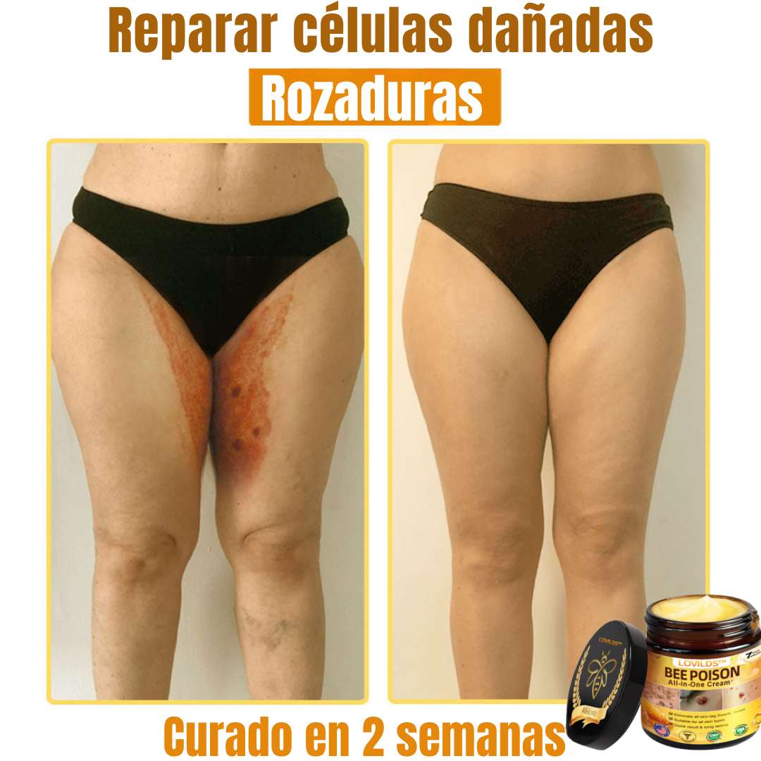 LOVILDS™ Bee Poison Cream  – Potencia natural para tu piel 🌿