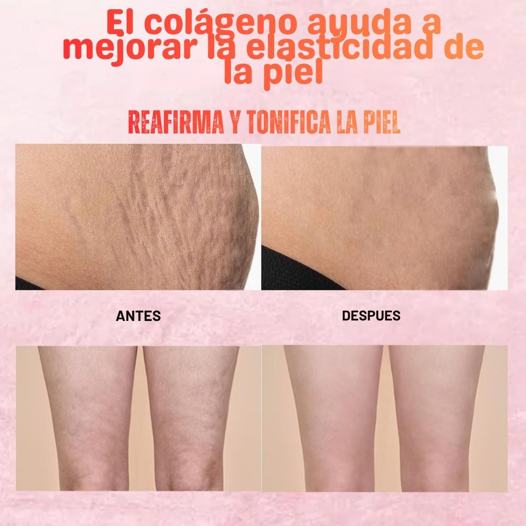 CANDELA™ Crema – Piel firme, Sin estrías y celulitis 🔥