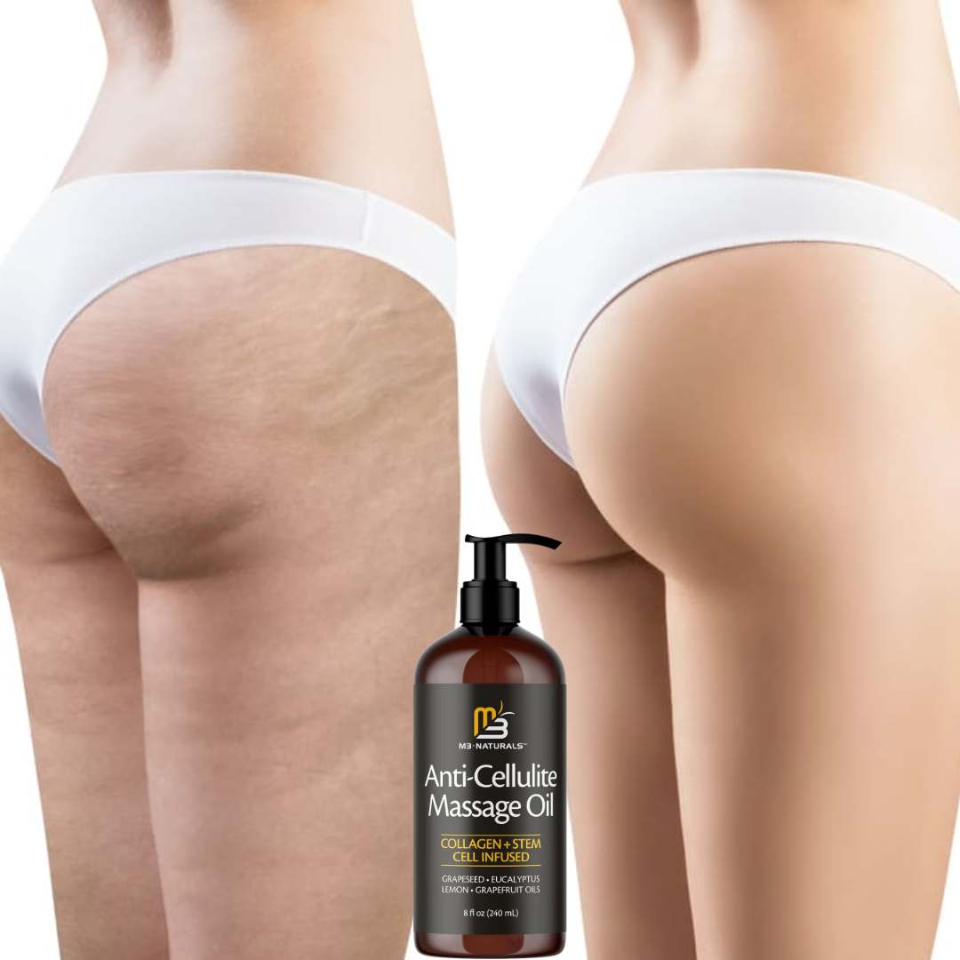 M3 Naturals™ Aceite Anticelulítico y Reafirmante para el Cuerpo 🌿